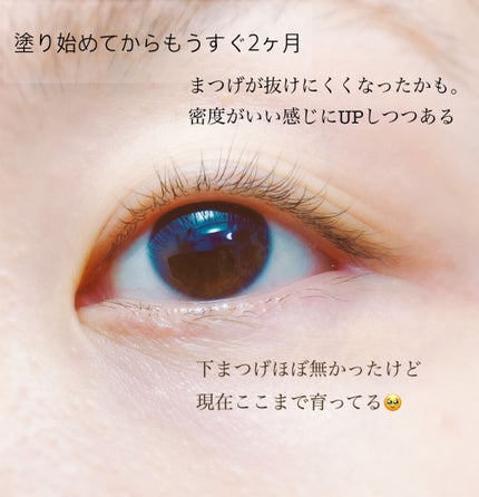 スカルプD ボーテ ピュアフリーアイラッシュセラム/アンファー(スカルプD)/まつげ美容液を使ったクチコミ(4枚目)