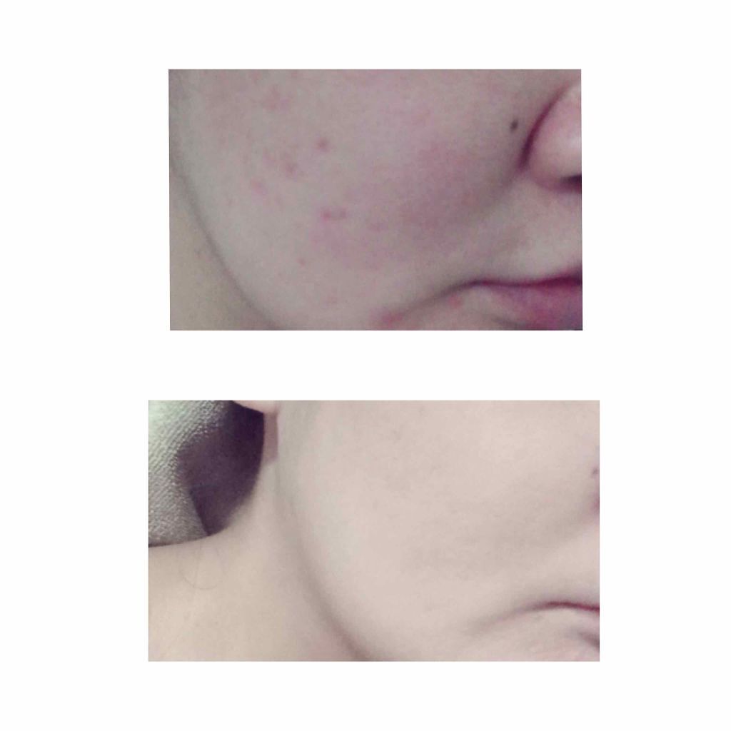 【旧品】マシュマロフィニッシュパウダー/キャンメイク/プレストパウダーを使ったクチコミ(4枚目)