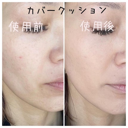 ピンクティーツリーカバークッション/APLIN/クッションファンデーションを使ったクチコミ(5枚目)