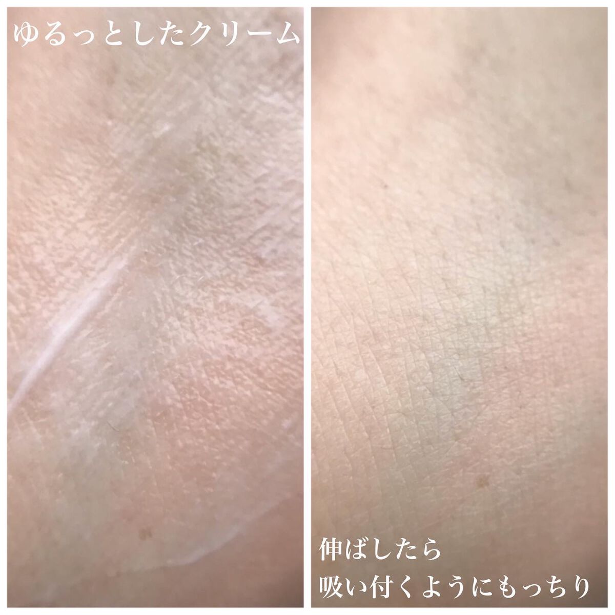 アドバンスバリア クリーム (敏感肌用クリーム)/iniks/フェイスクリームを使ったクチコミ(4枚目)