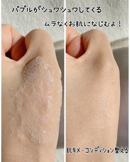 バブルエッセンス/ヒューマニズム/美容液を使ったクチコミ(6枚目)