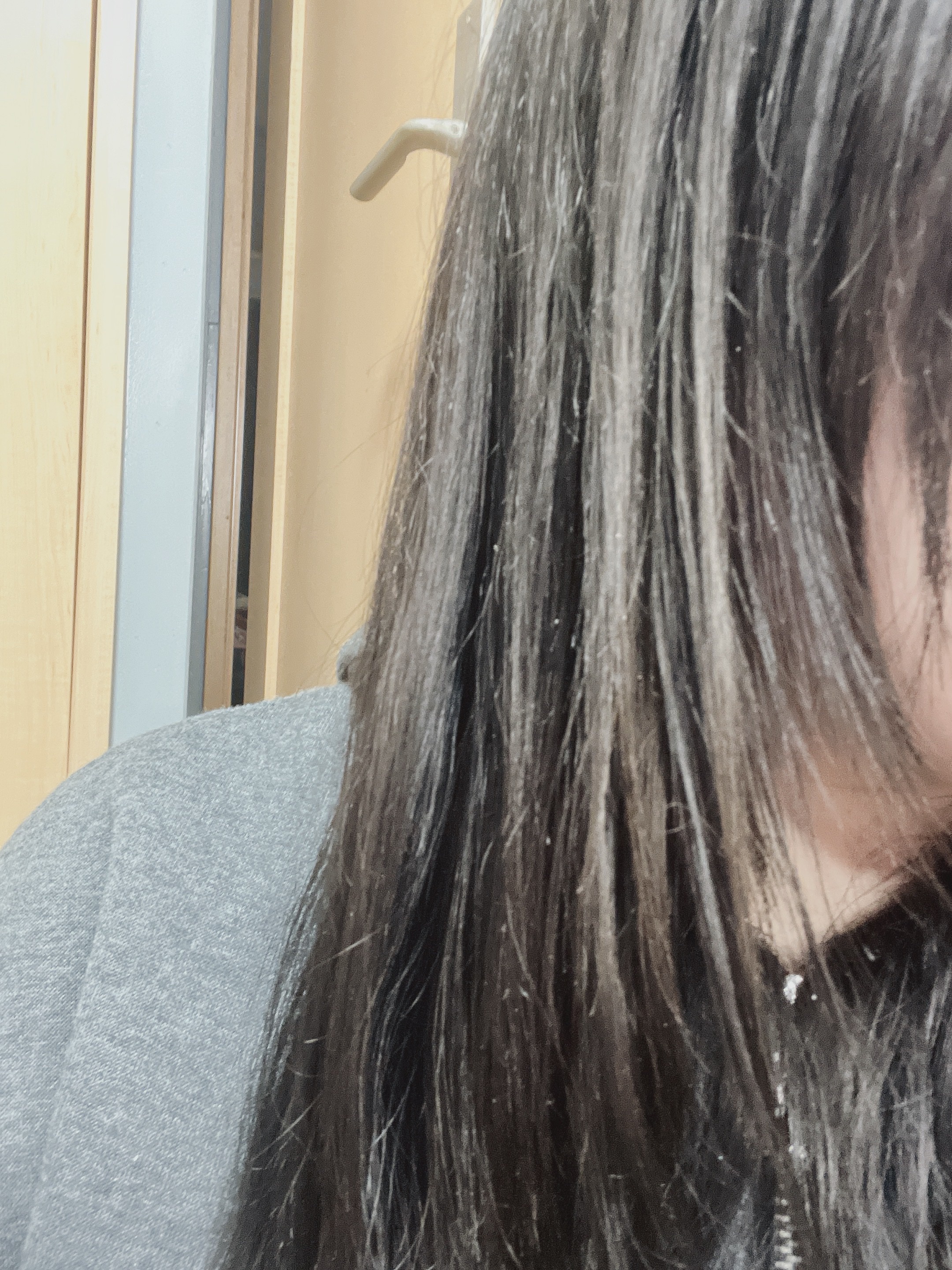 スカルプケアローション/WELLP/頭皮ローションを使ったクチコミ（3枚目）