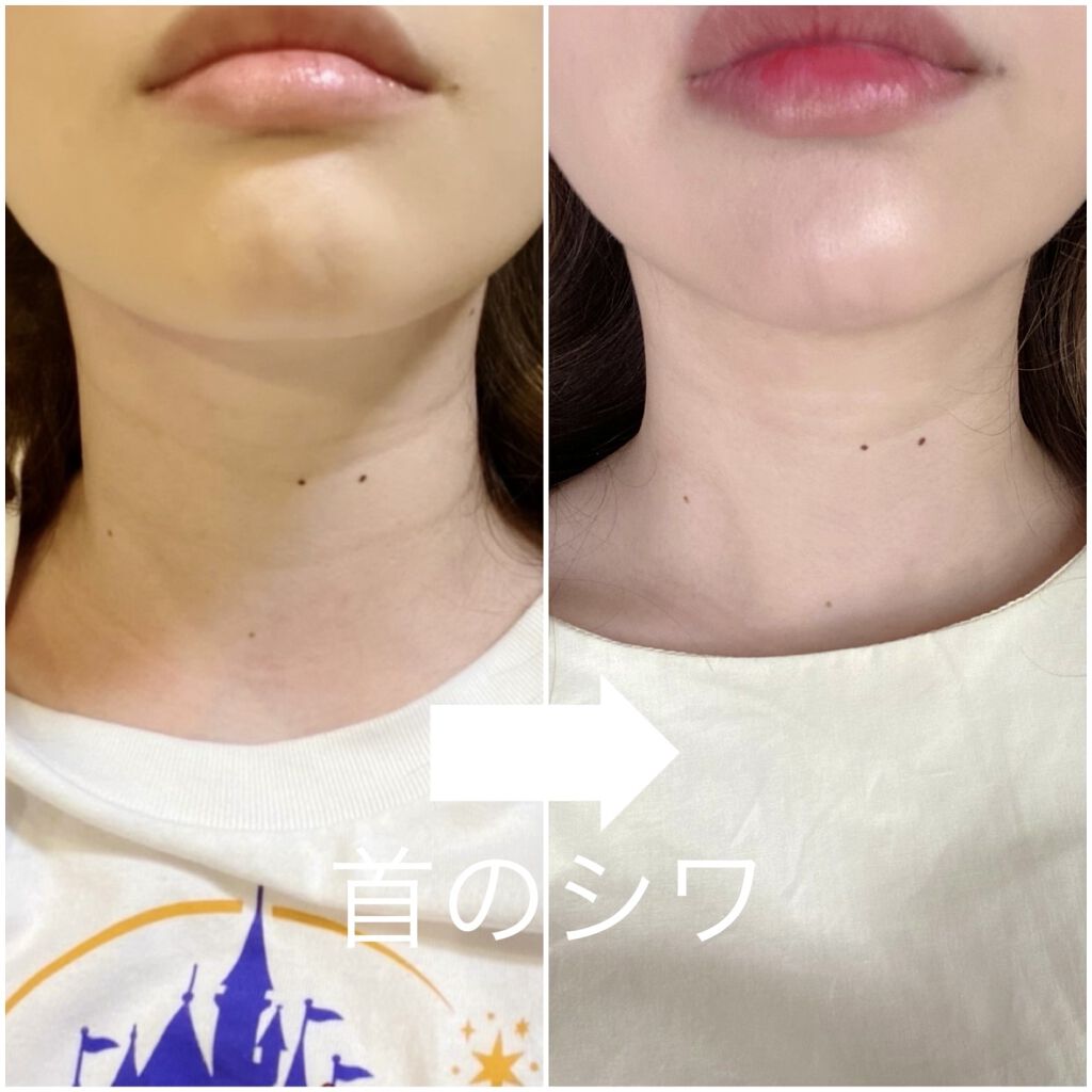 売り切れ続出の無印良品のエイジングケア薬用リンクルケアクリームマスク！

YouTubeでも紹介しましたが、本当に買ってよかったです。
使いはじめて1、2週間以上経ちましたが首のシワが少し薄くなりました！！！

明るさが若干違くて申し訳ない