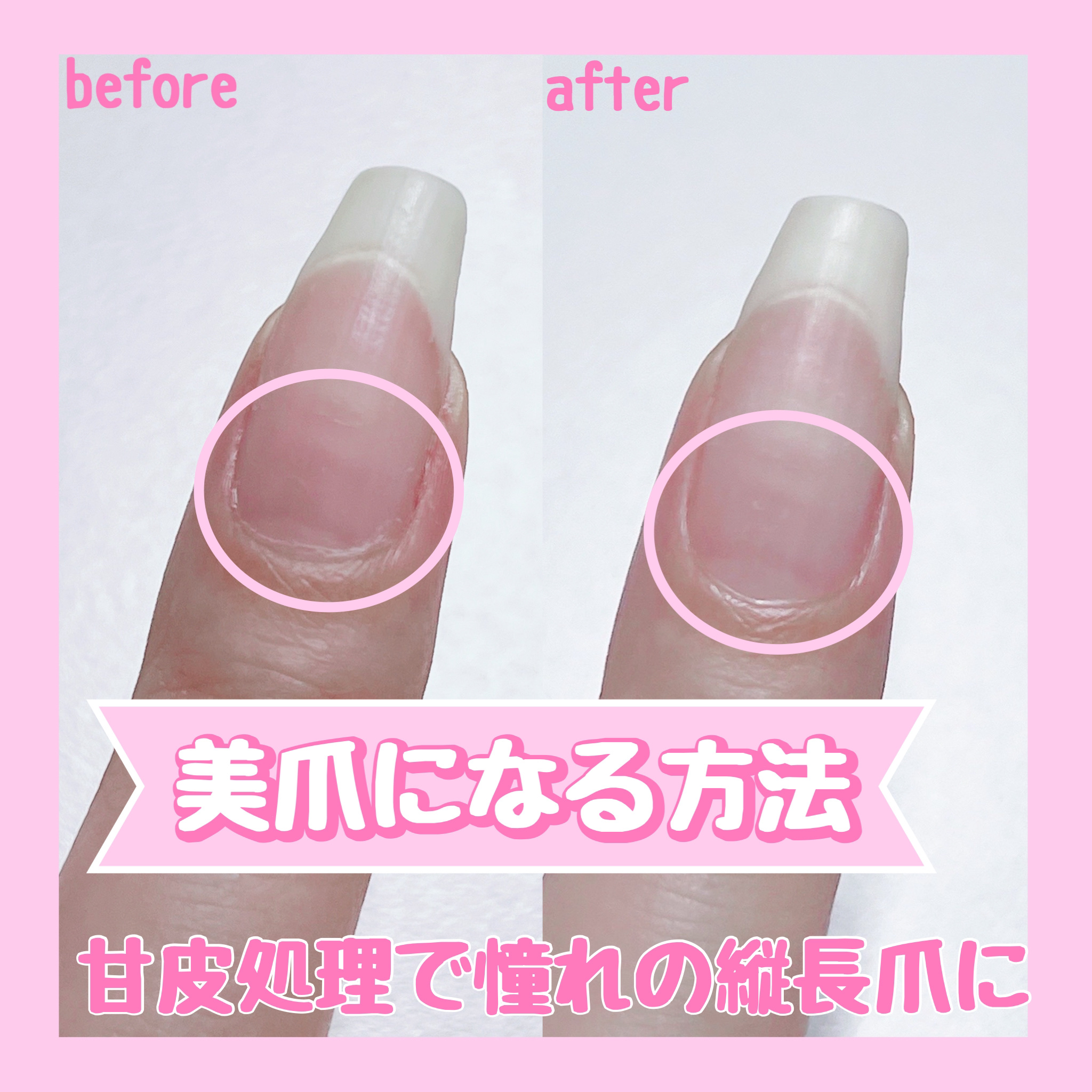 キューティクルリムーバー/BLUECROSS/ネイルオイル・トリートメントを使ったクチコミ（1枚目）