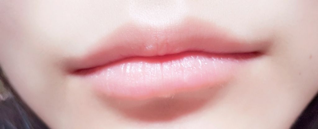 モアリップ N (医薬品)/資生堂薬品/その他を使ったクチコミ（2枚目）