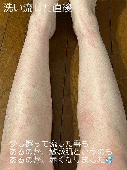 除毛クリーム リッチオイルケア/エピラット/除毛クリームを使ったクチコミ(4枚目)