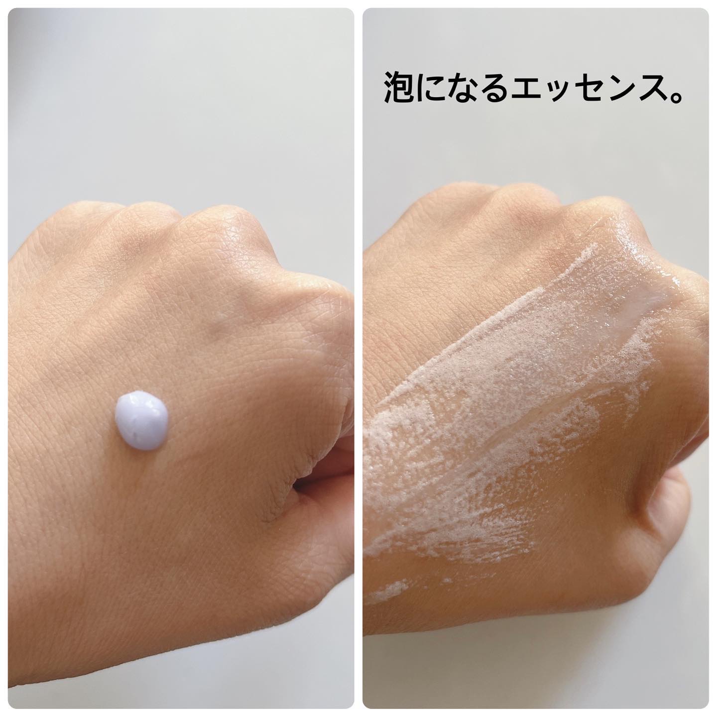 PEPTIDE VOLUME BOTUL-PEP WRINKLE AMPOULE /DR.PEPTI/美容液を使ったクチコミ（3枚目）