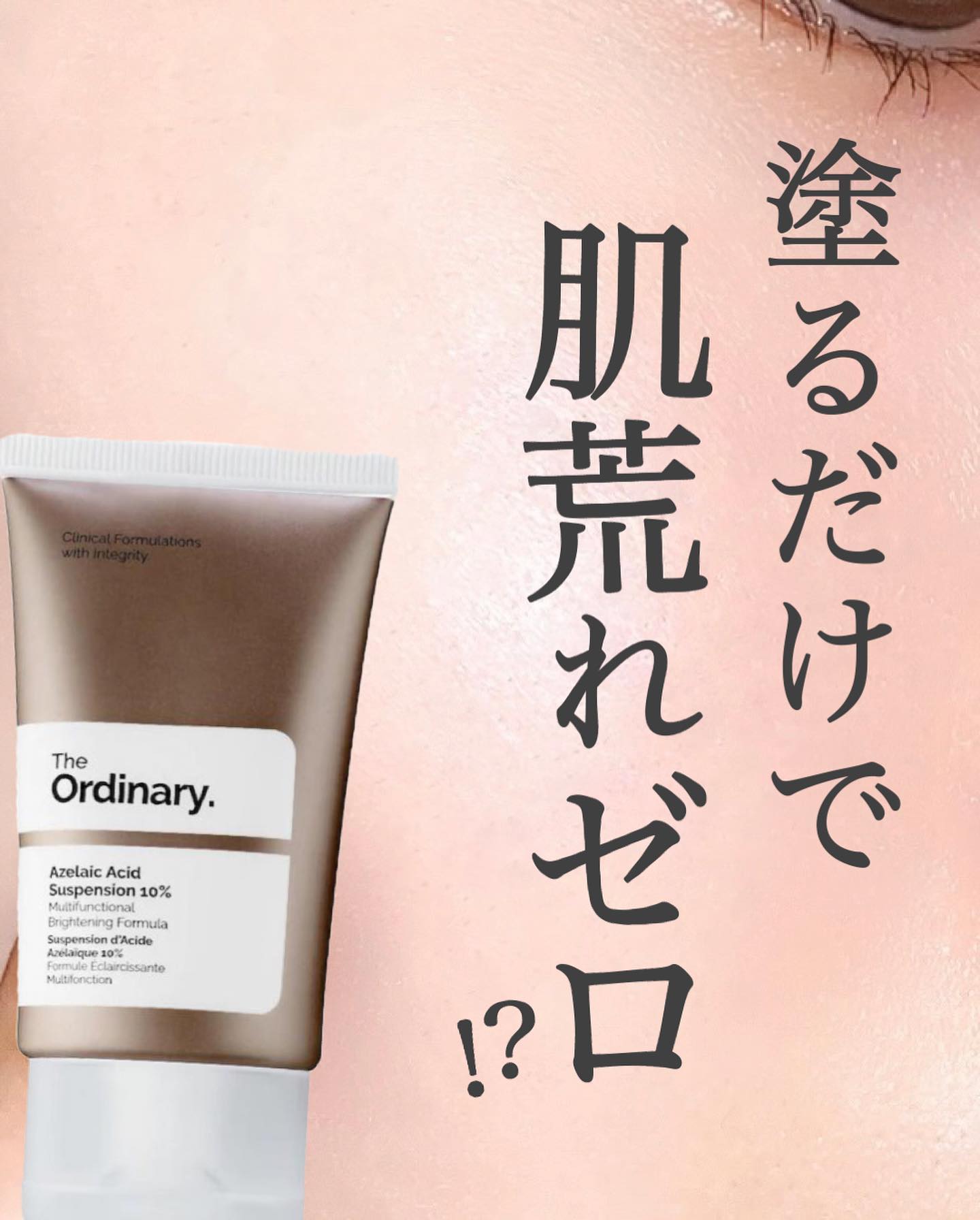 The Ordinary Azelaic Acid Suspension 10%のクチコミ「【ニキビ・毛穴が枯れる🥹！？】話題のプチプラアゼライン酸徹底解説🔍
⁡
今回紹介するのは、話題.....」（1枚目）