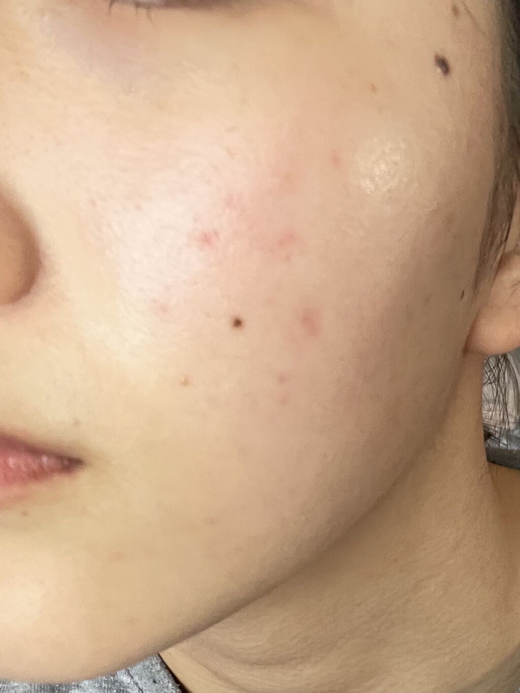 DHC ビタミンＣハードカプセル/DHC/美容サプリメントを使ったクチコミ（3枚目）