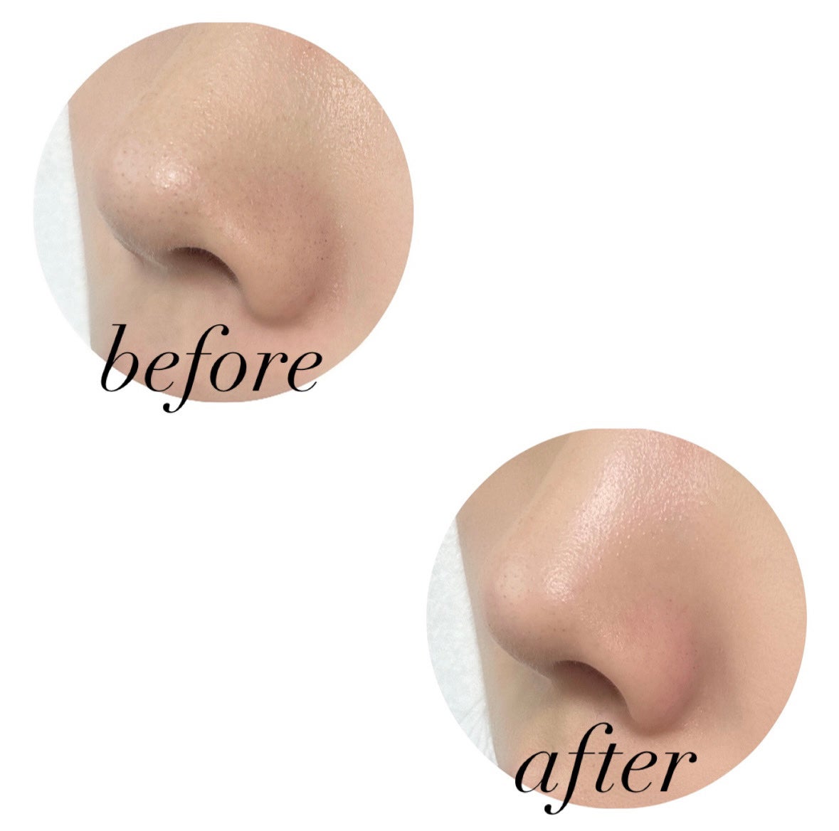 角質スッキリ毛穴パック /HANYUL(ハンユル)/洗い流すパック・マスクを使ったクチコミ(3枚目)