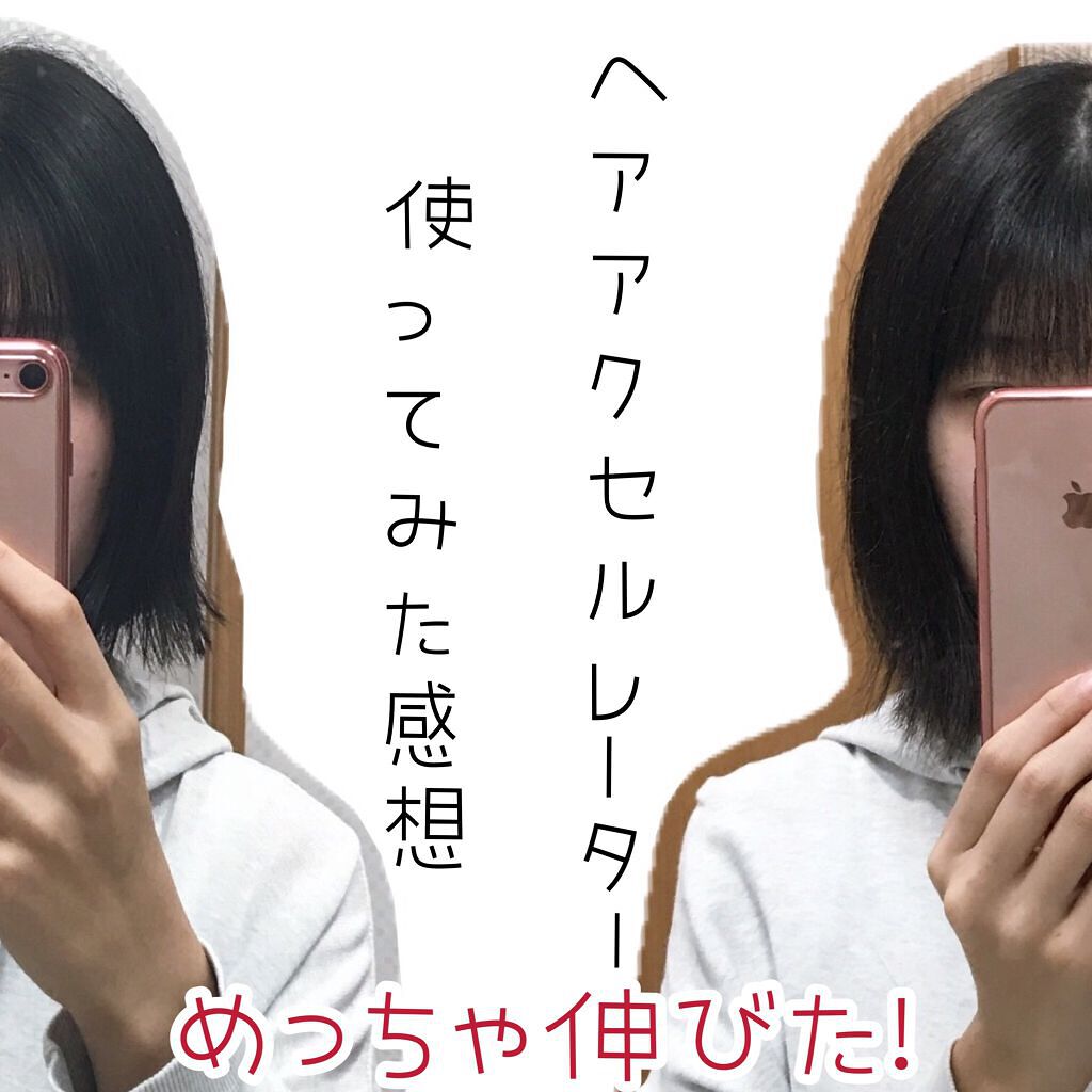 ヘアアクセルレーターEX フローラルアップルの香り/加美乃素本舗/頭皮ローションを使ったクチコミ(1枚目)