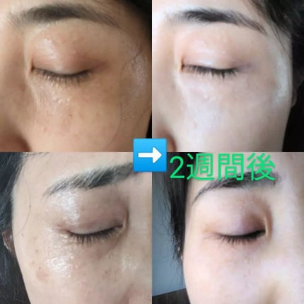 APRIAGEオイルS/AiB(エーアイビー)/ボディクリームを使ったクチコミ(1枚目)