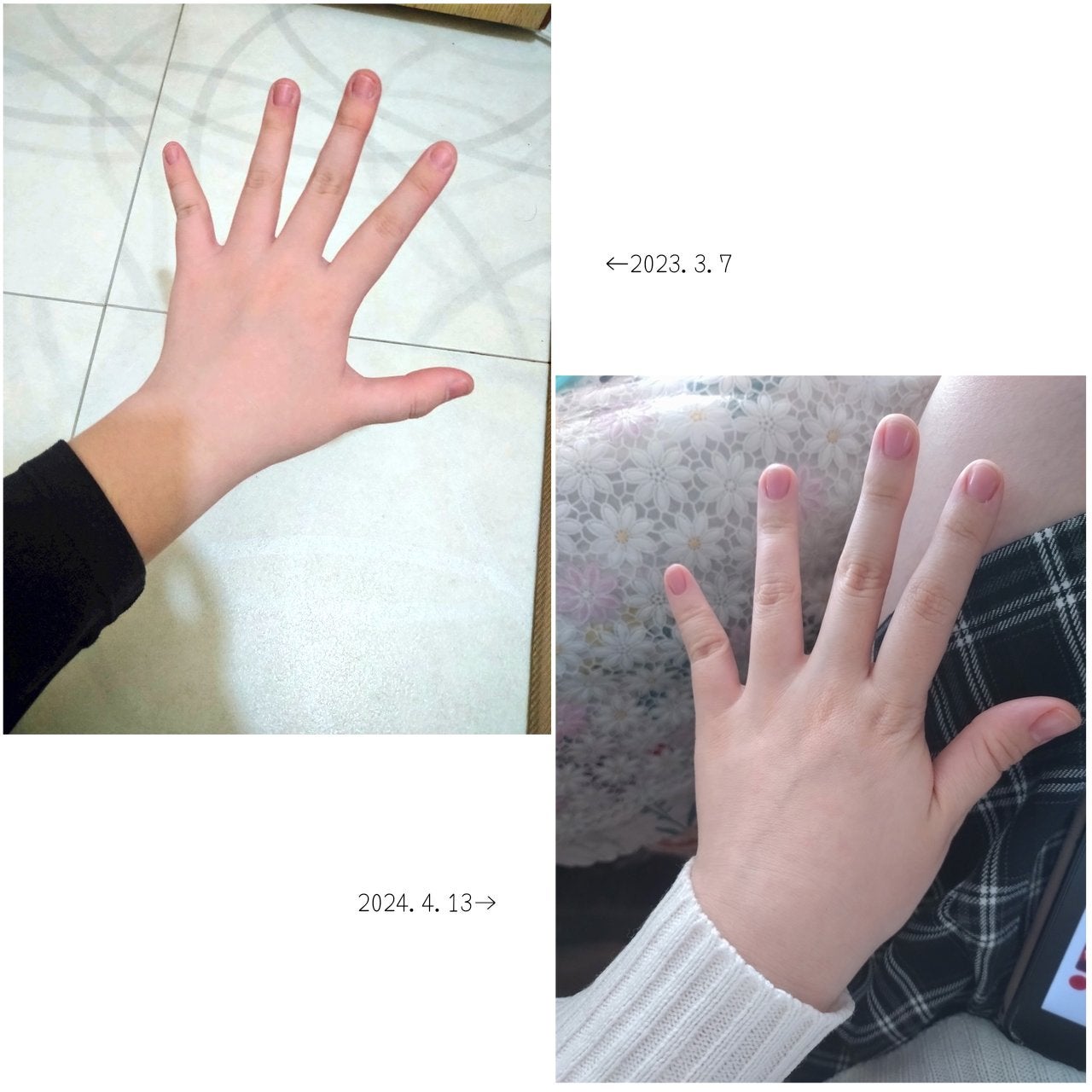 エテュセ クイックケアコート/ettusais/ネイルオイル・トリートメントを使ったクチコミ(1枚目)