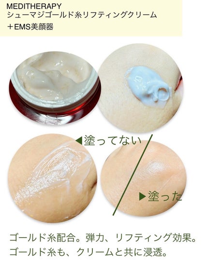 シューマジゴールド糸リフティングクリーム+EMS美顔器/MEDITHERAPY/フェイスクリームを使ったクチコミ(2枚目)