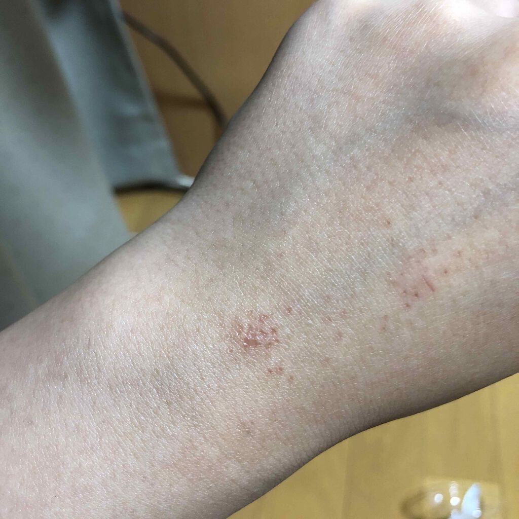 Kmyu(ケミュー)/CONTRIBUTION/除毛クリームを使ったクチコミ(3枚目)