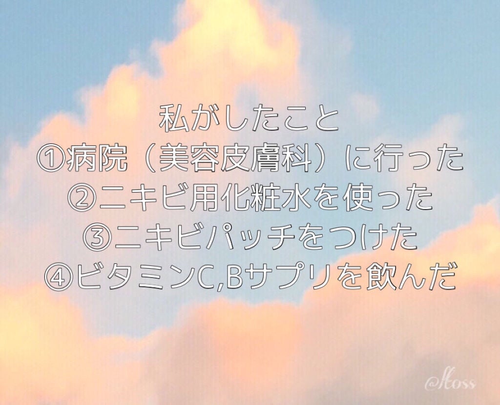 DHC ビタミンBミックス/DHC/美容サプリメントを使ったクチコミ(4枚目)