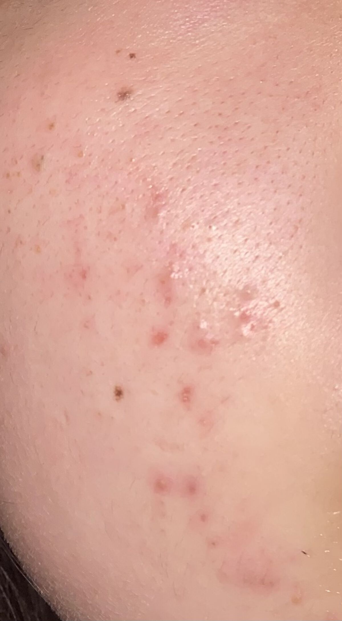 スーパーシカクリーム/MEDICUBE/フェイスクリームを使ったクチコミ（1枚目）