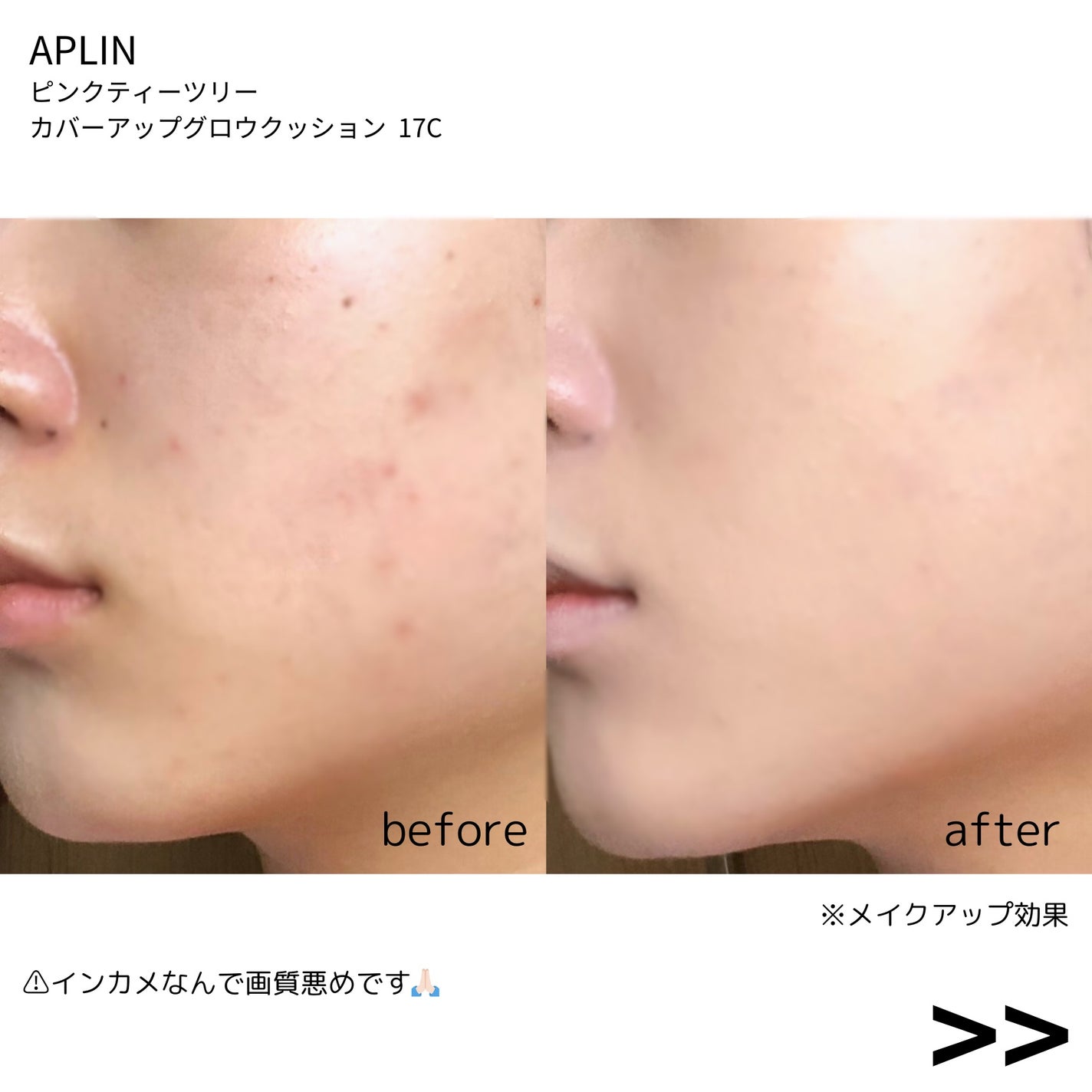 ピンクティーツリーカバーアップグロウクッション/APLIN/クッションファンデーションを使ったクチコミ(4枚目)