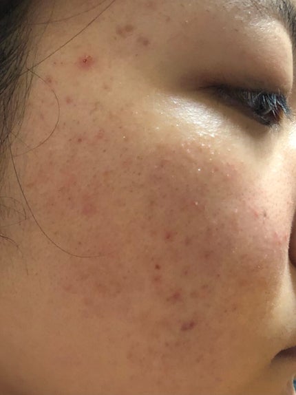 乳液・敏感肌用・しっとりタイプ/無印良品/乳液を使ったクチコミ(2枚目)