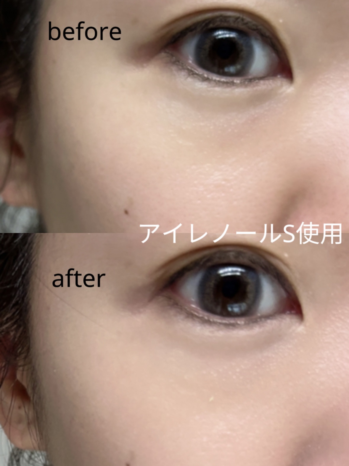 アイレノール クマクリーム/IRENOL/アイケア・アイクリームを使ったクチコミ（3枚目）