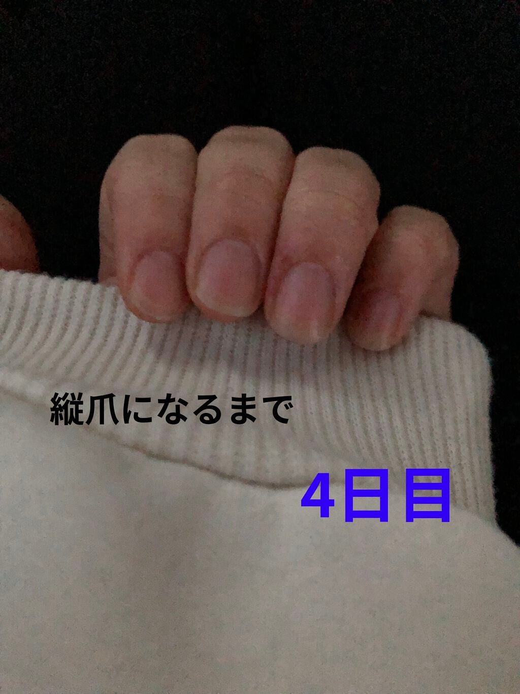 ð on LIPS ã瞊çªã«ãªãããã«ãããããªæ¹æ³ããã£ããæããŠãã ããð#䜿ã..ãïŒ1æç®ïŒ