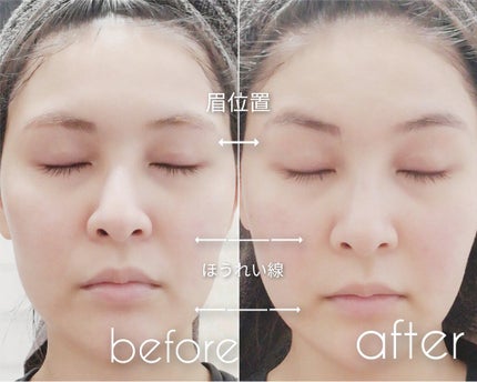 FacePump Premium(フェイスポンプ プレミアム)/the beautools/美顔器・マッサージを使ったクチコミ(4枚目)