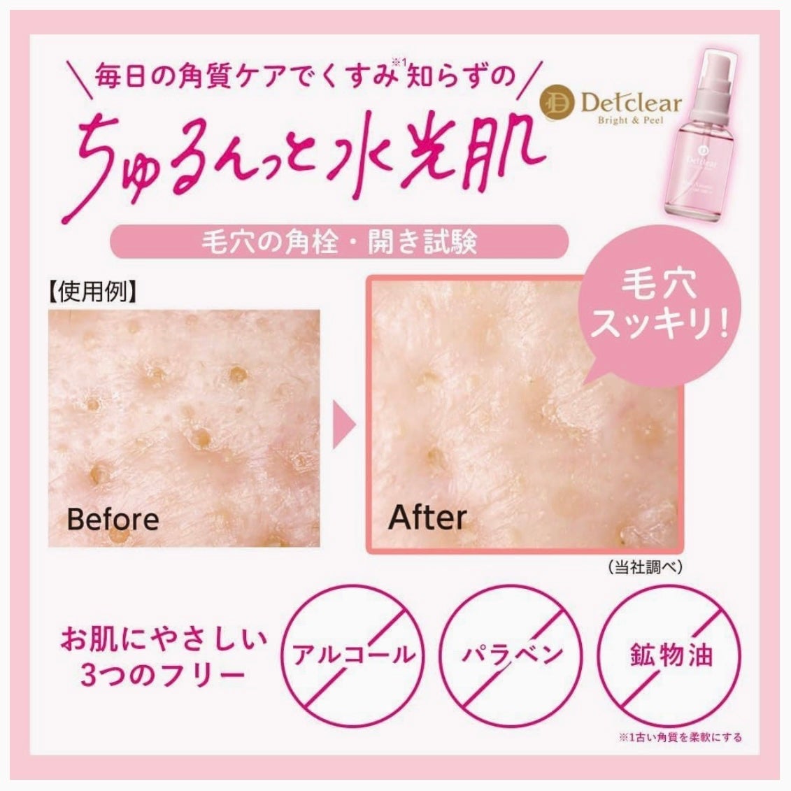 DETクリア ブライト&ピール ピール美容液/Detclear/美容液を使ったクチコミ(7枚目)
