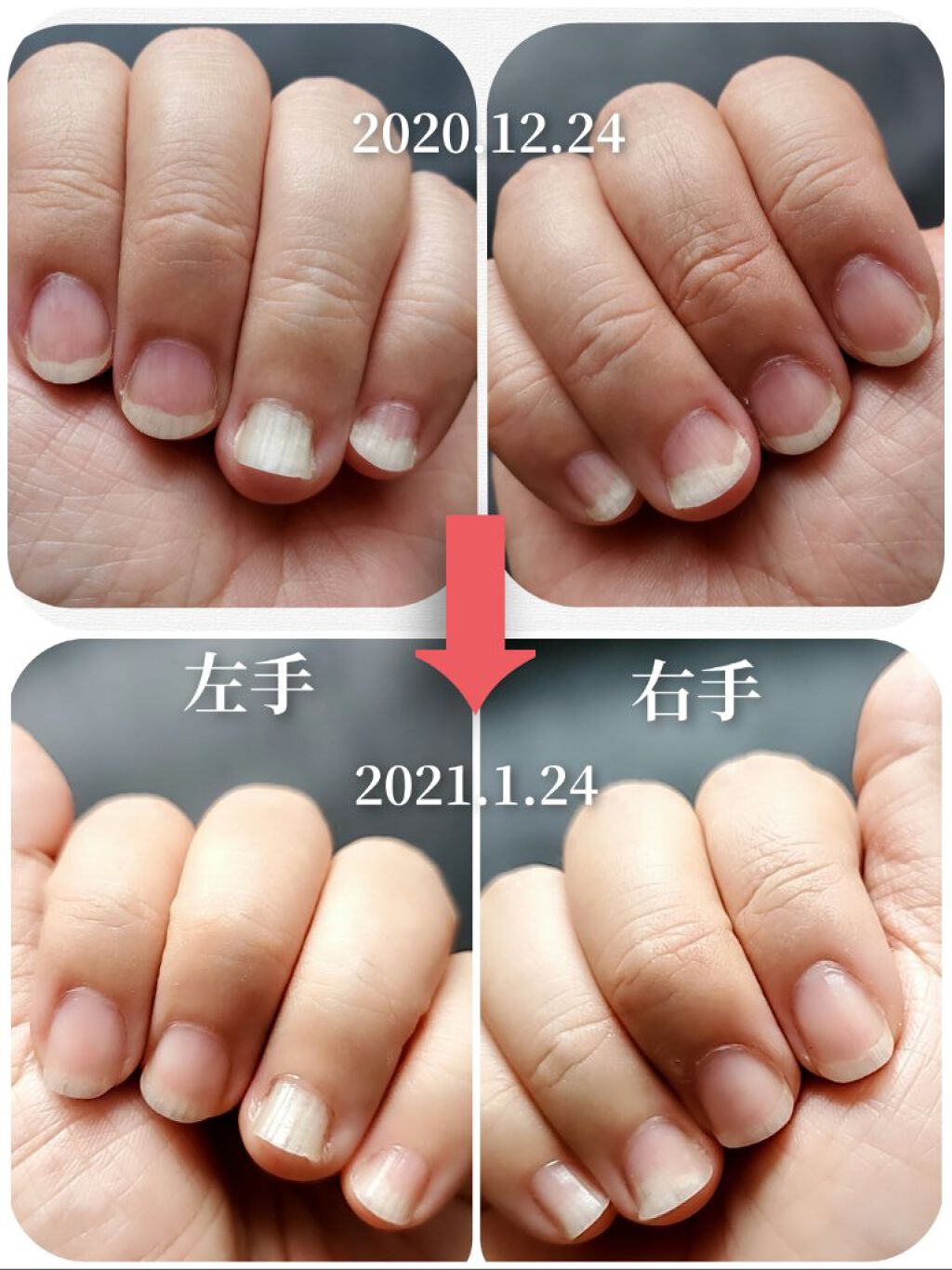 エテュセ クイックケアコート/ettusais/ネイルオイル・トリートメントを使ったクチコミ(2枚目)