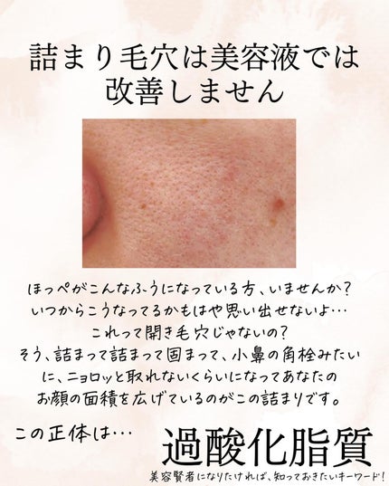おゆみ|ニキビ・ニキビ跡ケア on LIPS 「@______ohyoume他の投稿はこちらから💁♀️【なん..」(5枚目)