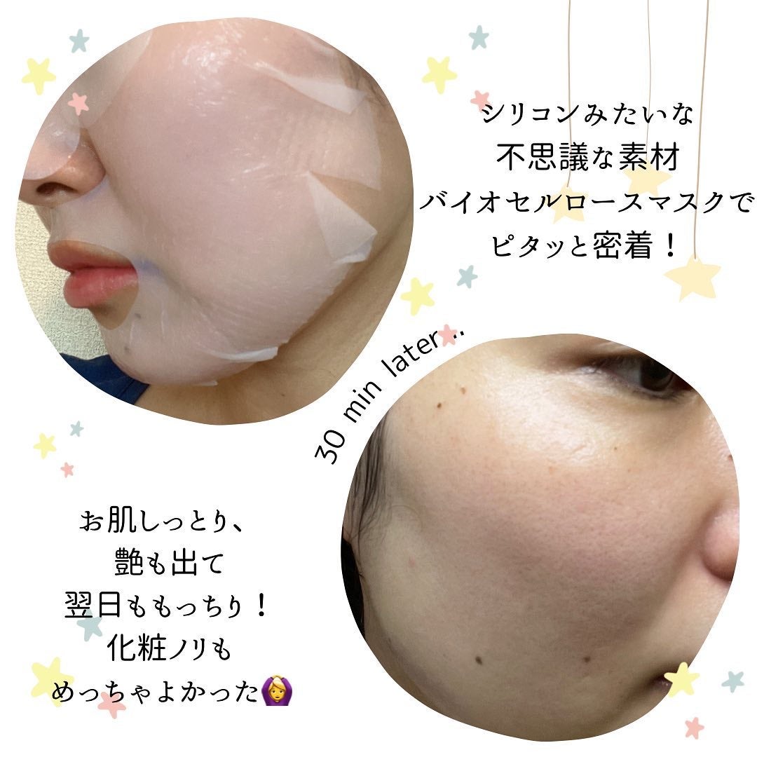 マイセルーチェ フェイシャルトリートメントマスク/MYCELLUCE/シートマスク・パックを使ったクチコミ(3枚目)