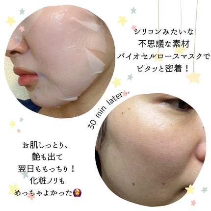 マイセルーチェ フェイシャルトリートメントマスク/MYCELLUCE/シートマスク・パックを使ったクチコミ(3枚目)