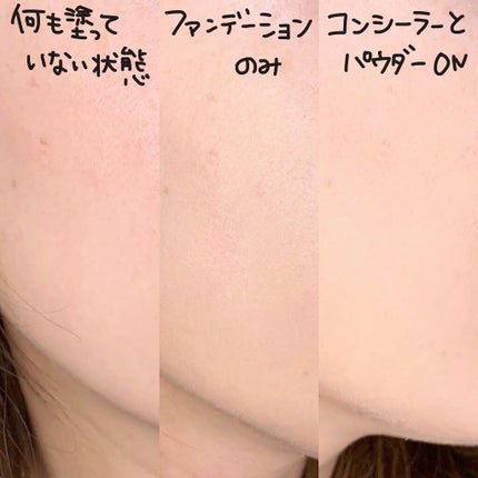 【旧】ディオールスキン フォーエヴァー フルイド グロウ/Dior/リキッドファンデーションを使ったクチコミ(5枚目)