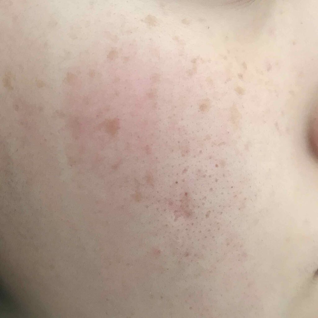 ゼロクッション/rom&nd/クッションファンデーションを使ったクチコミ(2枚目)