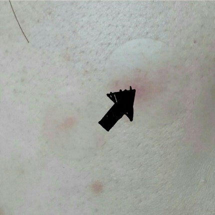 Secret solution Clear Patch/It's skin/シートマスク・パックを使ったクチコミ(2枚目)