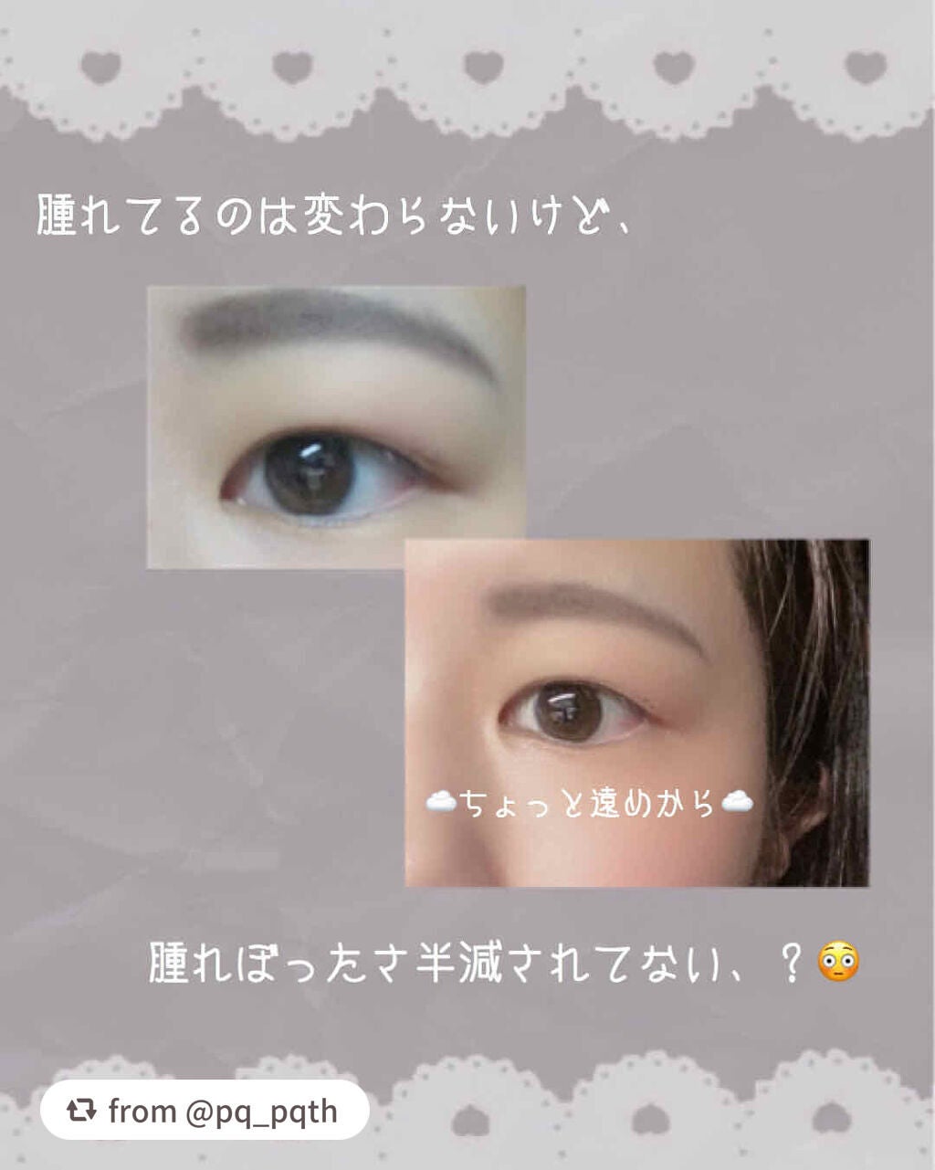 アイトーク スーパーホールド/アイトーク/二重まぶた用アイテムを使ったクチコミ(3枚目)