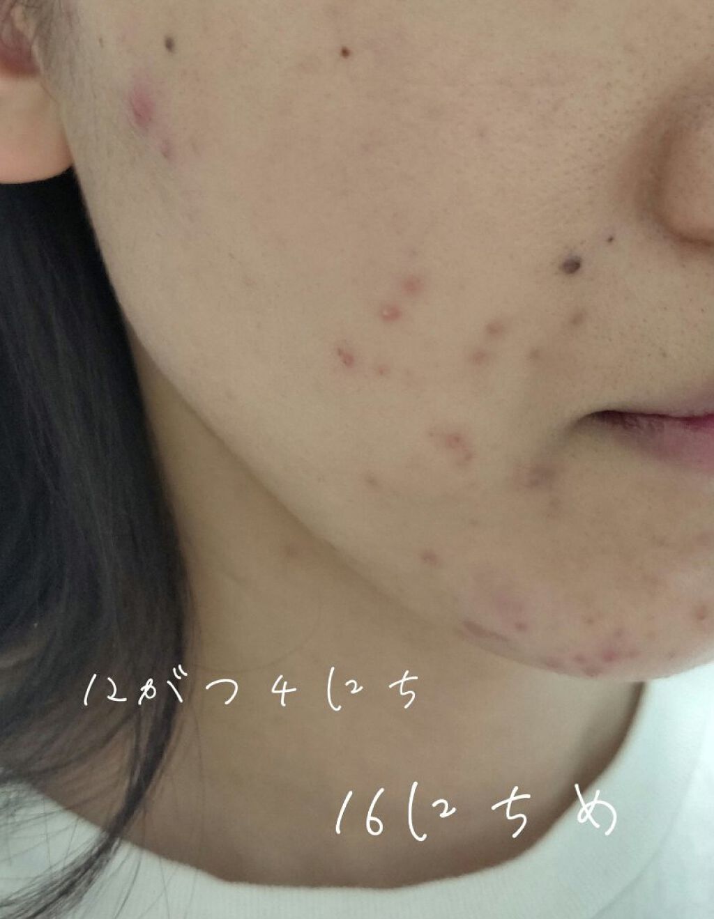 チョコラBBプラス (医薬品)/チョコラBB/その他を使ったクチコミ（3枚目）