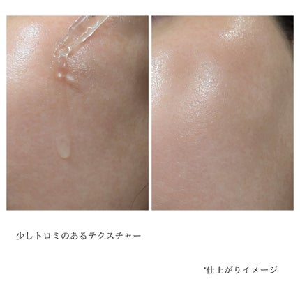 131 ポア クリアリング セラム/Celladix/美容液を使ったクチコミ(3枚目)