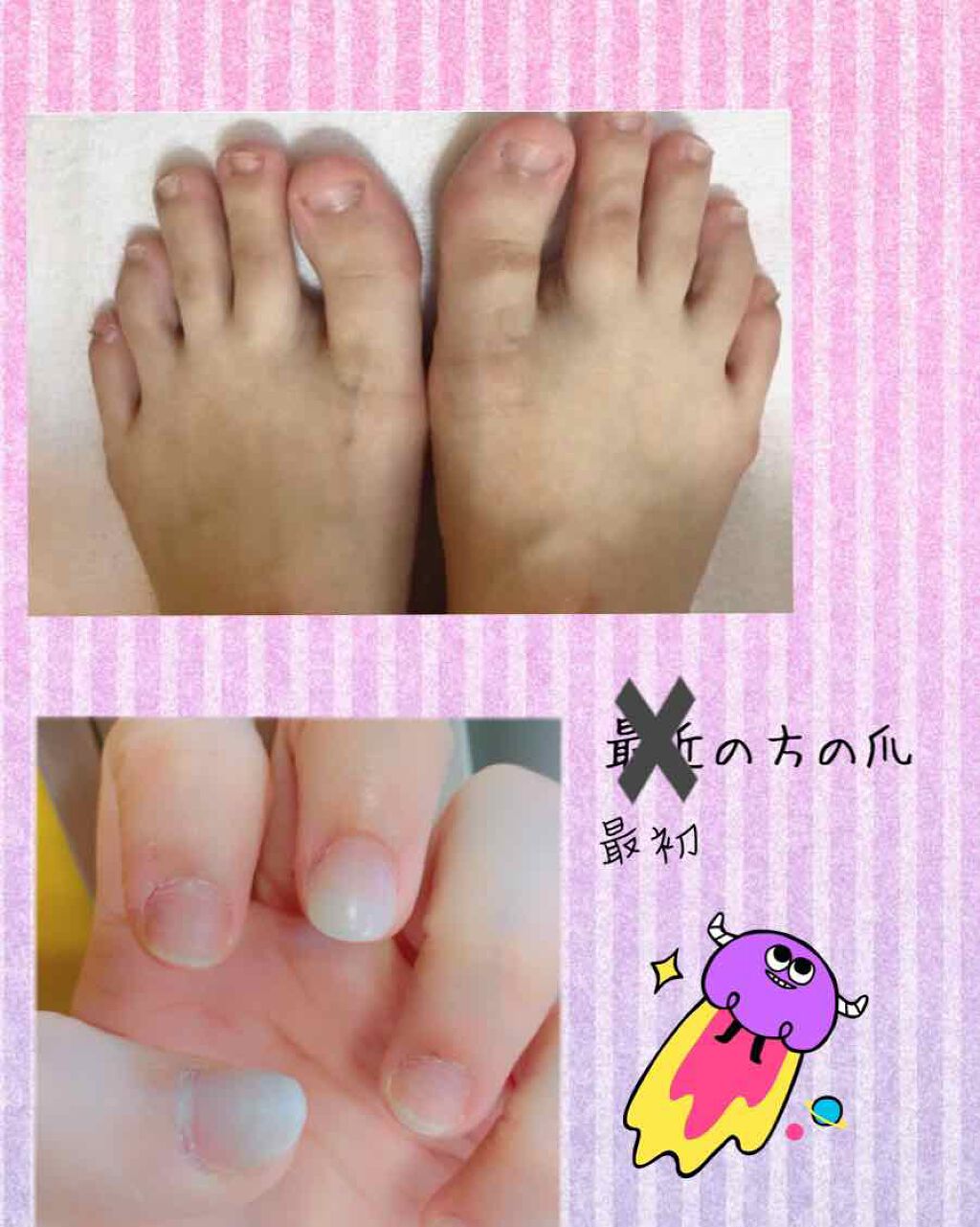 EB ボトルジェル トップ&ベース/eternal basic/ネイルトップコートを使ったクチコミ(2枚目)