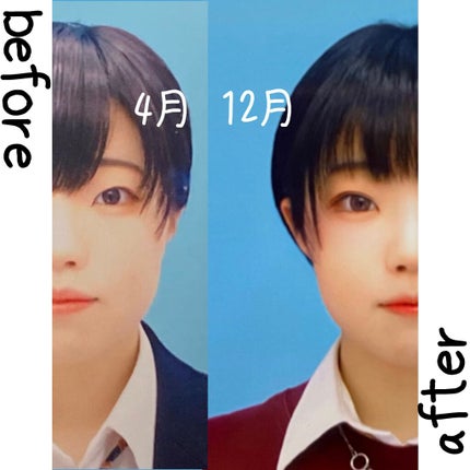 アイテープ(絆創膏タイプ、レギュラー、70枚)/DAISO/二重まぶた用アイテムを使ったクチコミ(2枚目)
