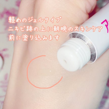 ニキビあとケアジェル/アットノン/その他スキンケアを使ったクチコミ(3枚目)