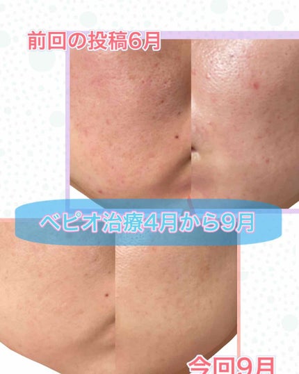 amin on LIPS 「こんにちは!先日、フツーに歩いてたらつまずいちゃって、何につま..」(2枚目)