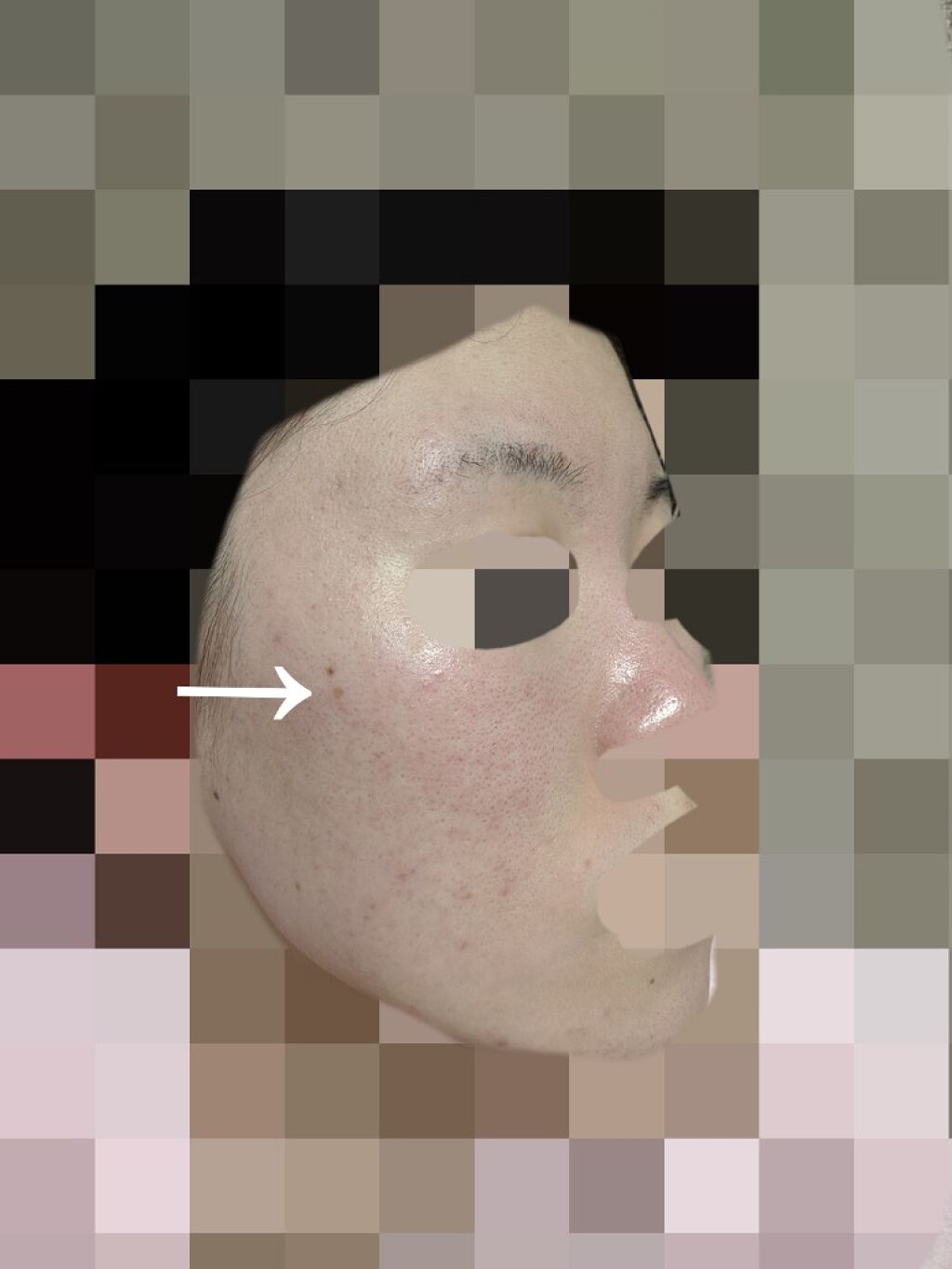 エバレッシュホワイトEXⅡ(医薬品)/matsukiyo/その他を使ったクチコミ（2枚目）