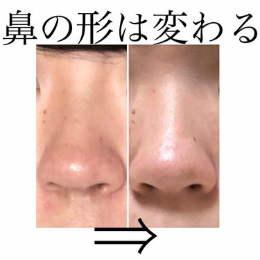 林檎 on LIPS 「即効性あり！！！だんご鼻必見絶対に鼻の形が綺麗になる(小鼻が小..」（1枚目）