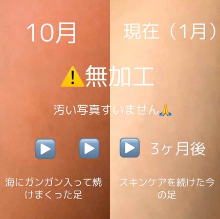 ハトムギ化粧水(ナチュリエ スキンコンディショナー R )/ナチュリエ/化粧水を使ったクチコミ(2枚目)