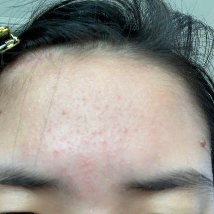 ハトムギ化粧水(ナチュリエ スキンコンディショナー R )/ナチュリエ/化粧水を使ったクチコミ(3枚目)