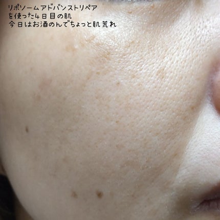 リポソーム アドバンスト リペアセラム/DECORTÉ/美容液を使ったクチコミ(6枚目)
