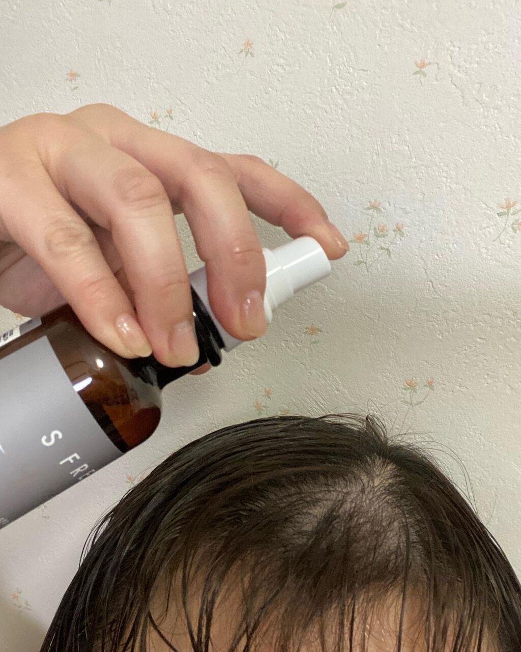 薬用ヘッドスパセラム/S FREE/頭皮ローションを使ったクチコミ(3枚目)