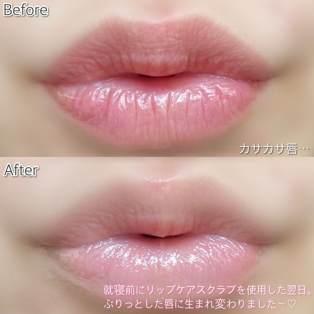 プランプリップケアスクラブ/キャンメイク/リップスクラブを使ったクチコミ(6枚目)