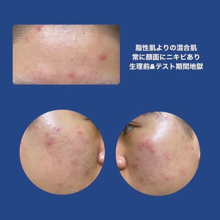 マイルドクレンジング オイル/ファンケル/オイルクレンジングを使ったクチコミ(2枚目)