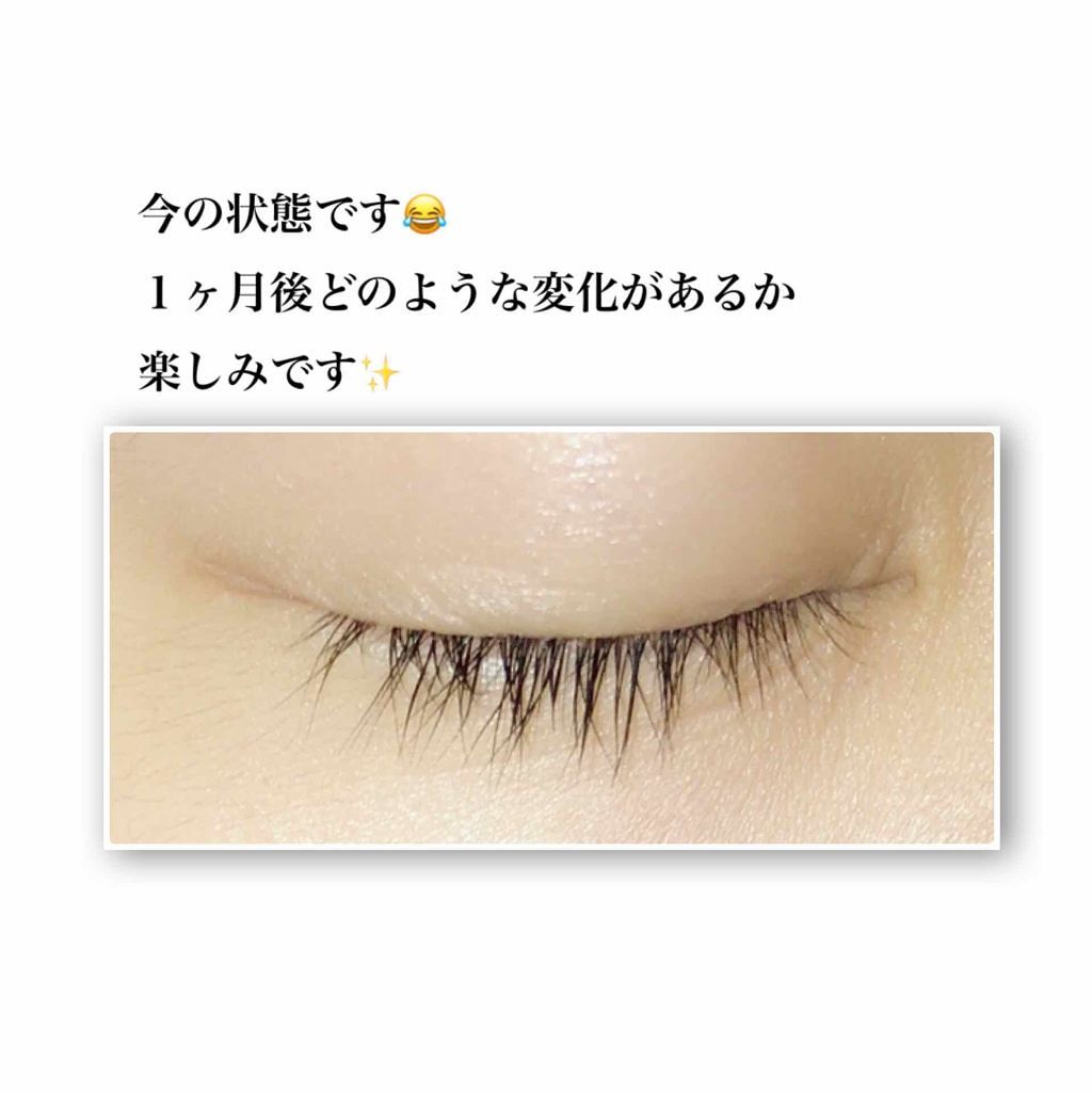 EMAKED(エマーキット)/水橋保寿堂製薬/まつげ美容液を使ったクチコミ(1枚目)